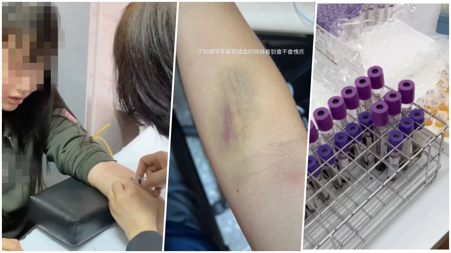 台師大女足選手被迫抽血換學分、當「血牛」,教練周台英還威脅「不配合就休學」,且傳出是由非醫療專業人員違法抽血,女學生手臂滿是抽血瘀青、痛爆崩潰哭泣。翻攝自當事人社群Threads