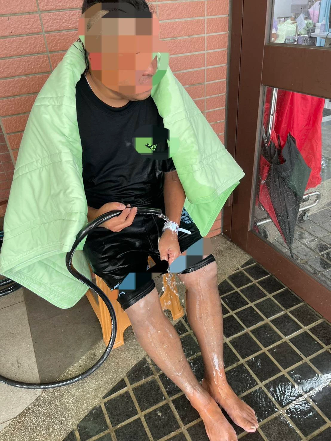 屏東縣恆春鎮福德路的廟會活動,今天下午4時許發生鞭炮施放意外,一名傷者拿水管朝燙傷處沖水降溫。讀者提供