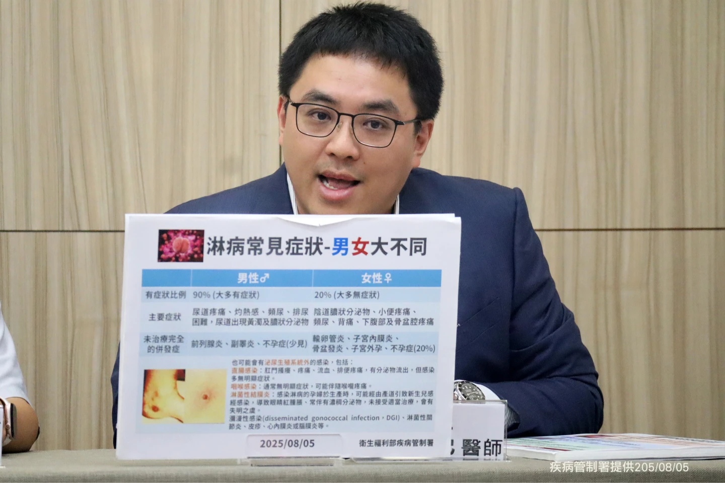 醫師陳伯亮說明梅毒。疾管署提供