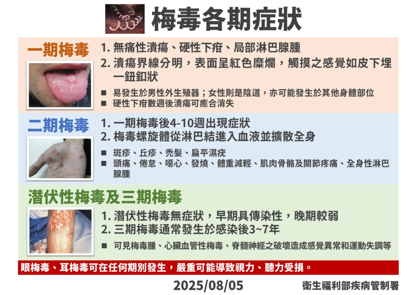 梅毒各期症狀。疾管署提供