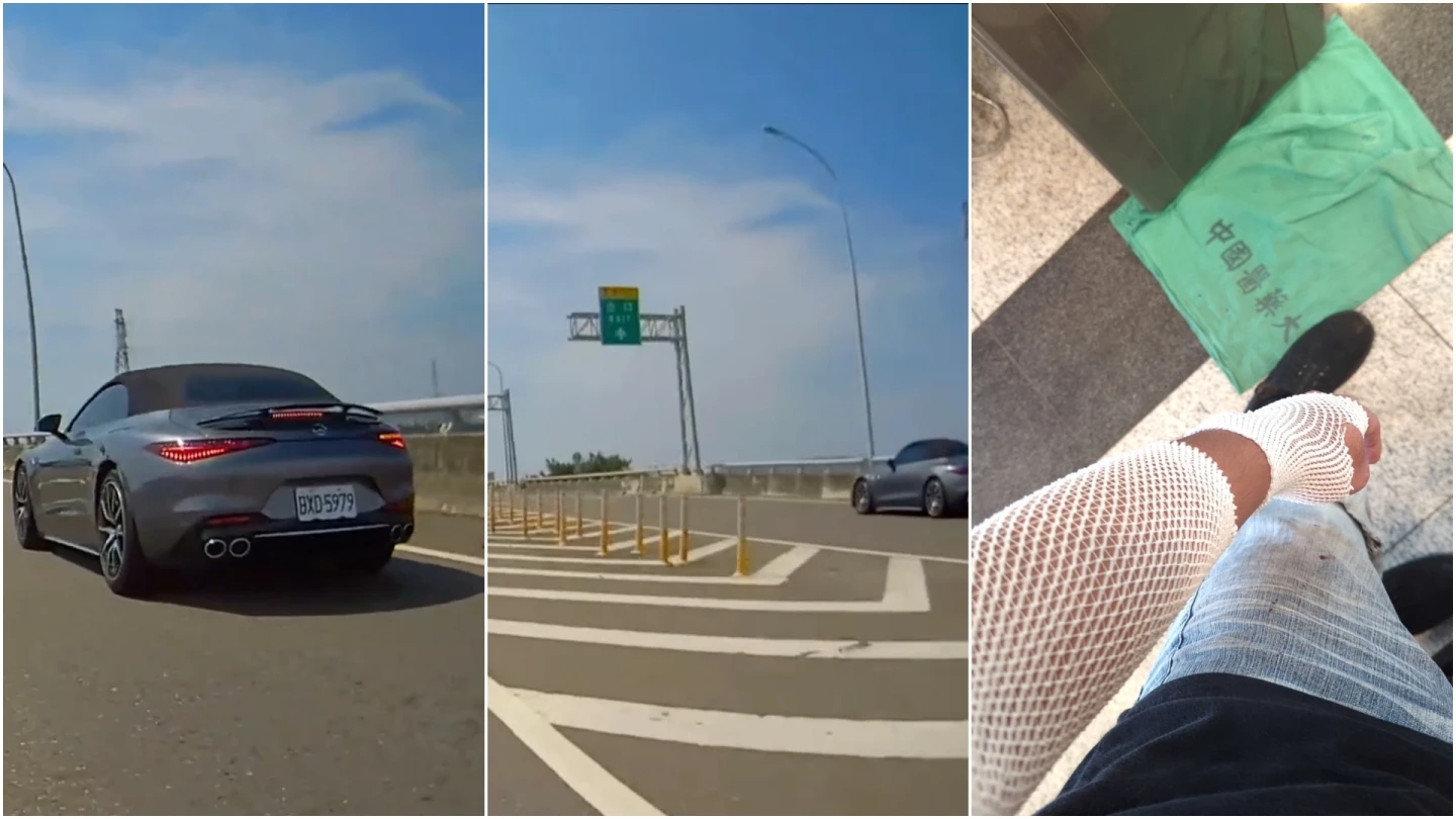 肇事敞篷賓士未停車,逕行下交流道駛離(左、中),重機騎士左手受傷,前往醫院治療(右)。取自FB@爆料公社
