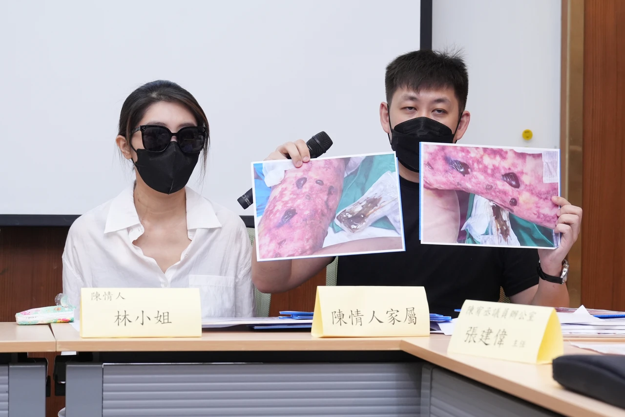 陳情人林小姐在恆美學信義診所接受抽脂與脂肪填補手術,發生急性腎衰竭。葉志明攝