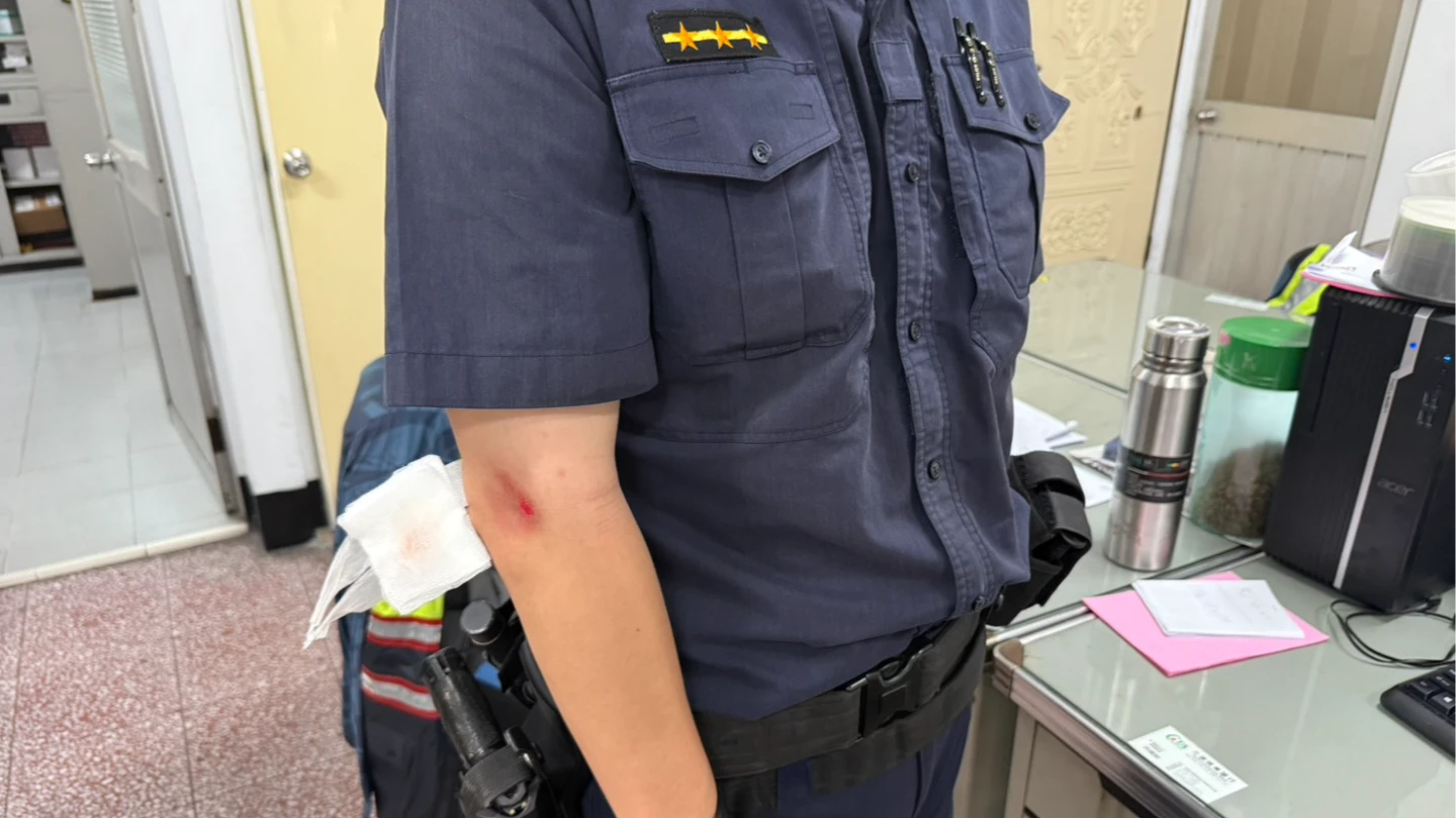 警員黃柏翰遭嫌犯汽車衝撞,造成右手肘受傷。民眾提供