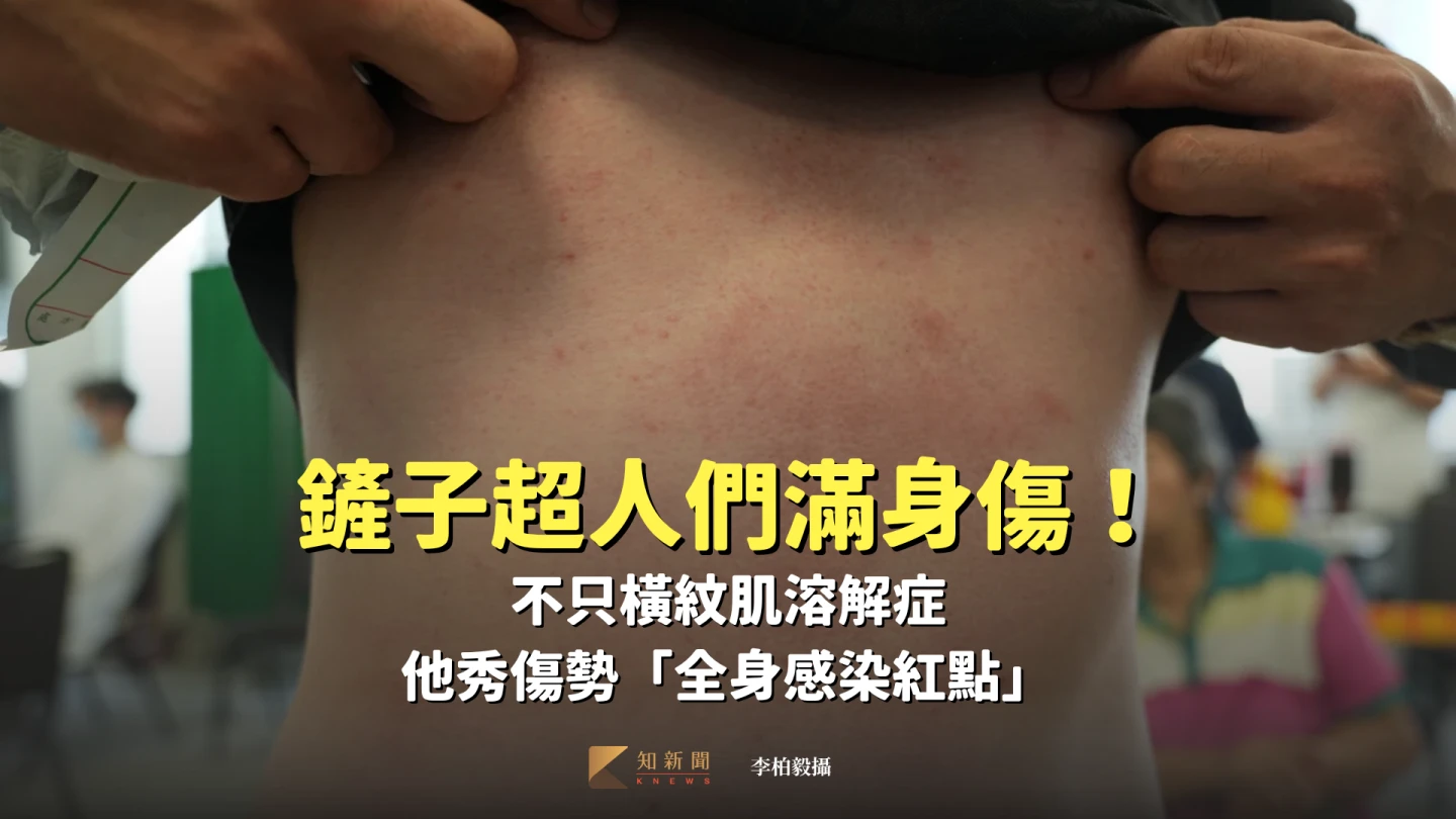 鏟子超人們滿身傷!不只橫紋肌溶解症 他清淤泥5天「全身感染紅點」