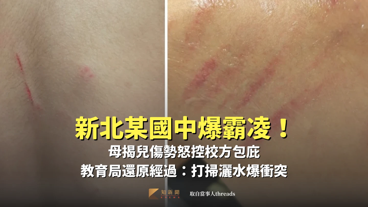 新北某國中爆霸凌！母揭兒傷勢怒控校方包庇　教育局還原經過：打掃灑水爆衝突
