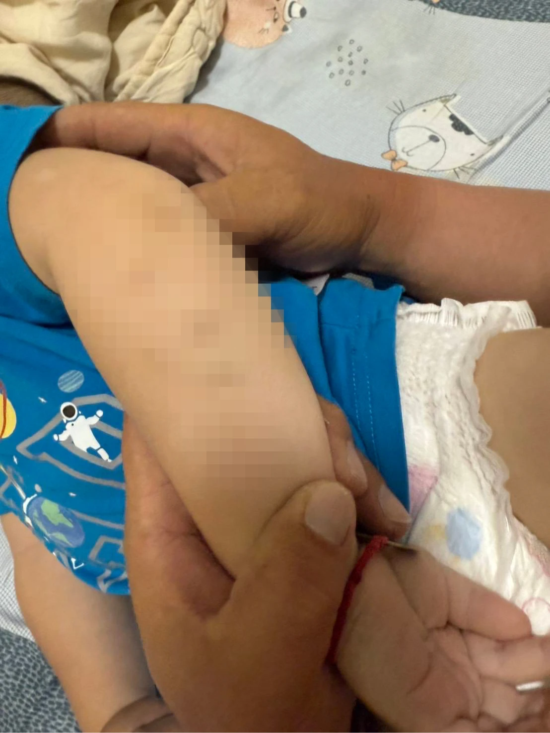 家長質疑孩子被捏打。邱于軒提供