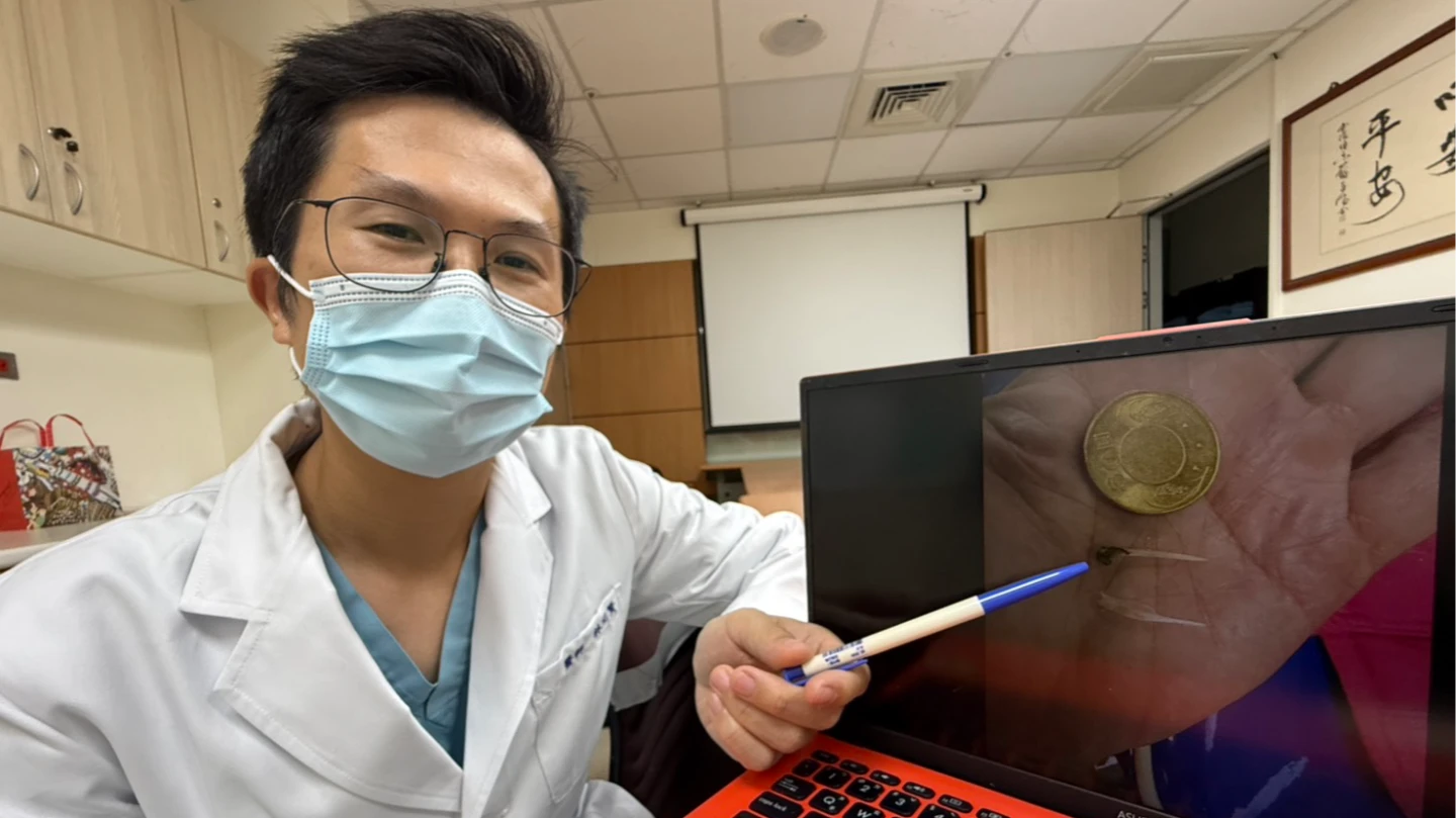 醫師說明患者不慎吞下魚刺卡在食道。臺中醫院提供