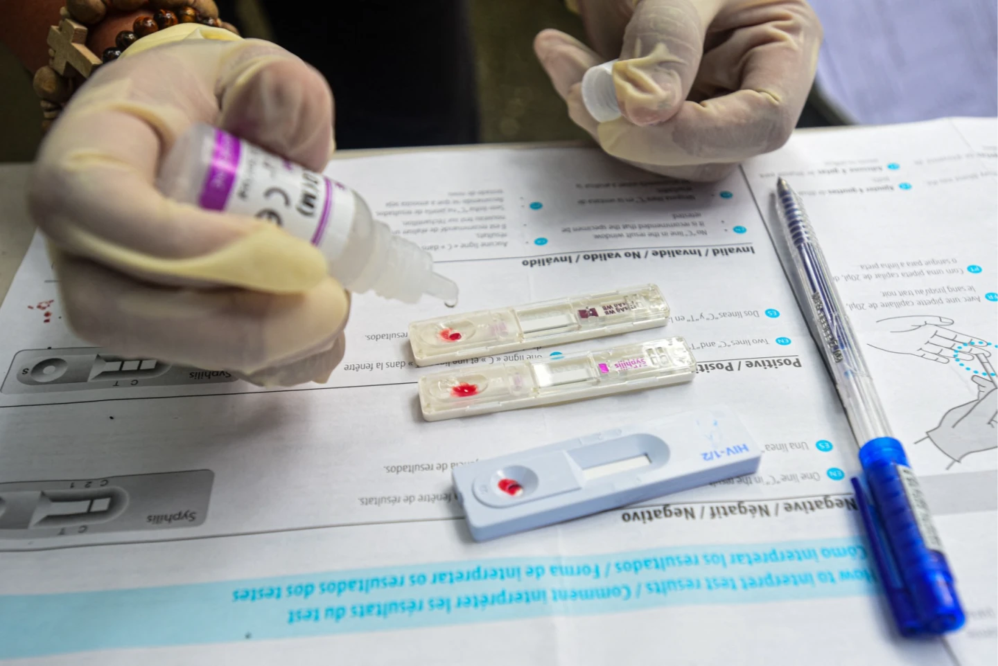 菲律賓HIV病例14年來暴增6倍,是西太平洋HIV疫情最嚴重的國家。圖為志工正在使用HIV快篩進行檢測。資料照片。法新社