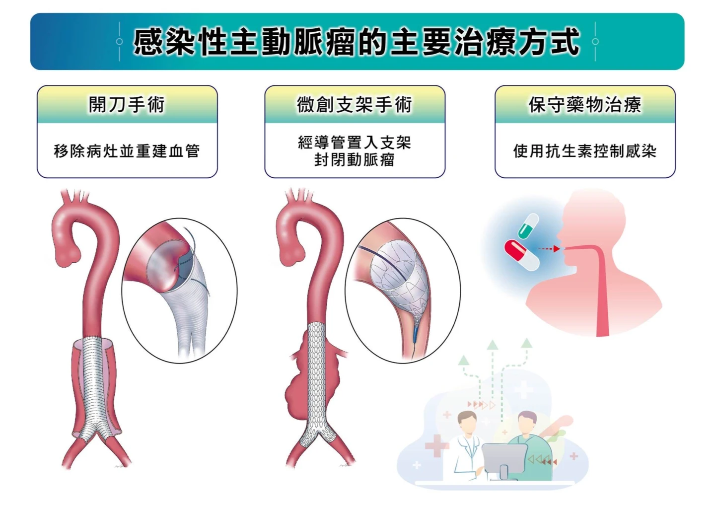 感染性原發主動脈瘤的三種治療方式。長庚提供