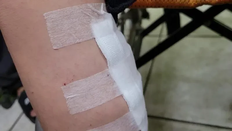 葉姓男童在自家附近遭梁男飼養的黑狗從後方撲倒撕咬,造成小腿撕裂傷,送醫縫合16針。翻攝畫面