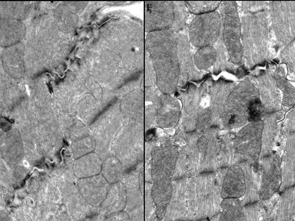 左圖為使用小紅莓治療後的小鼠心肌細胞,黑色類似峽谷的地方為心肌受損;右圖使用橙皮素後可看見受損慢慢復原。國衛院提供