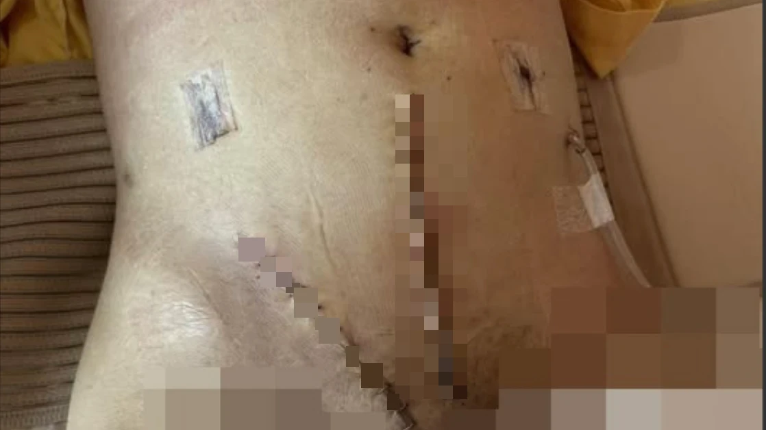 微創手術竟險死！她刮除子宮肌瘤穿孔大出血　國軍高雄總醫院遭控疏失回應了