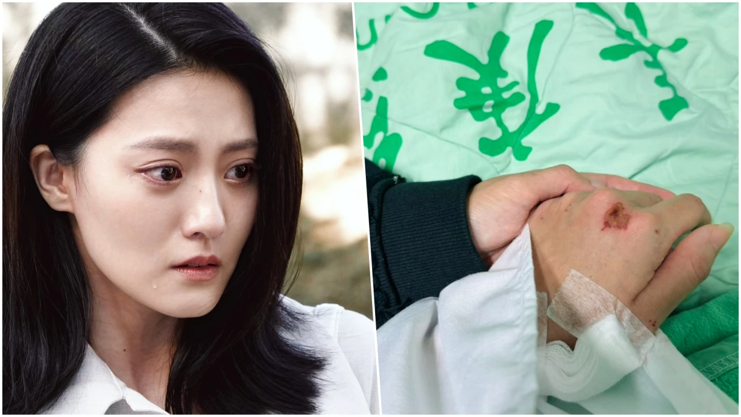 女星顏曉筠被撞飛！肩脫臼韌帶斷滿臉血　每天機車通勤2小時出事了