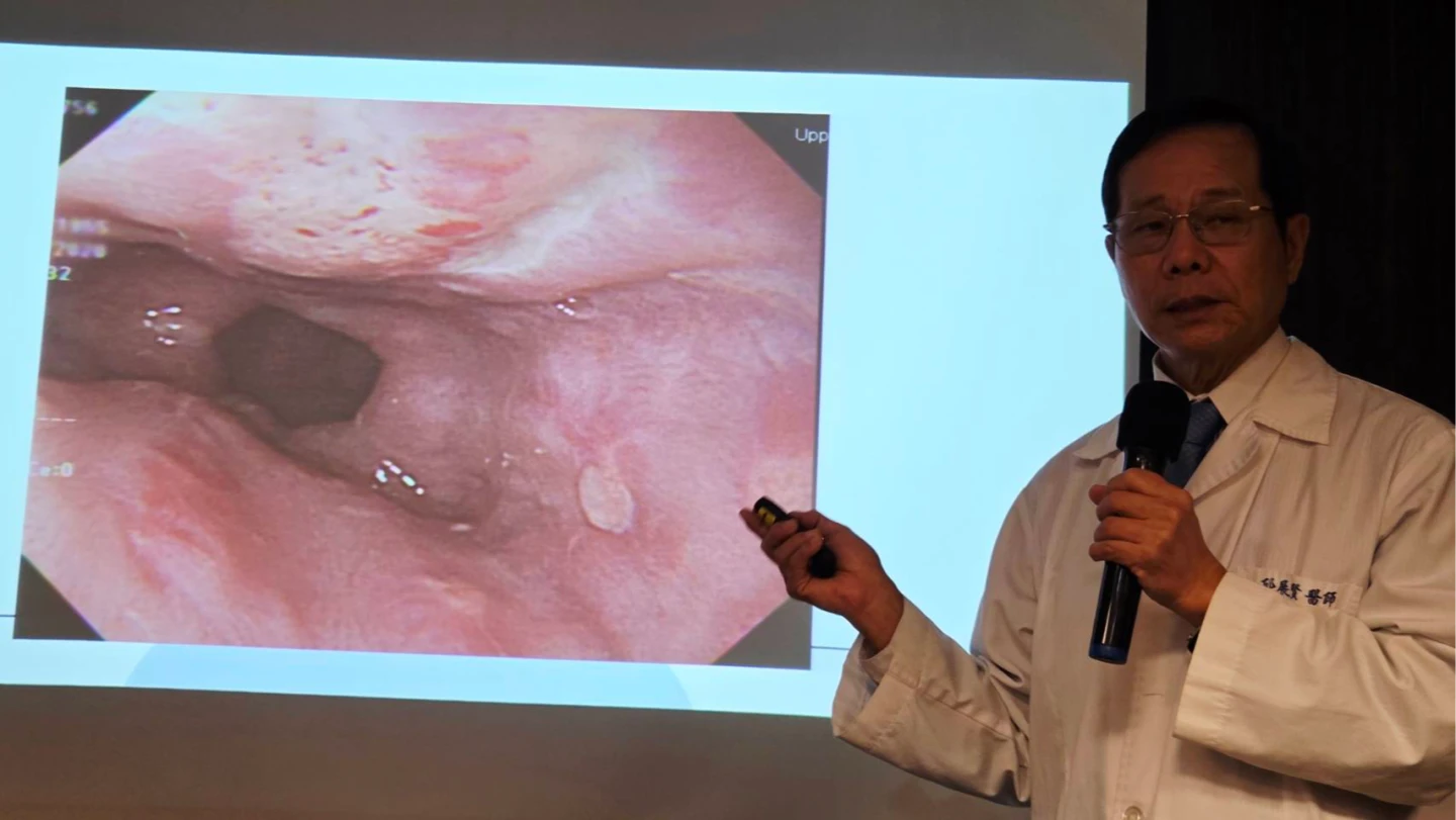 翁日吞20顆保健品害胸悶！食道滿是腐蝕痕　掌握4點正確吃藥