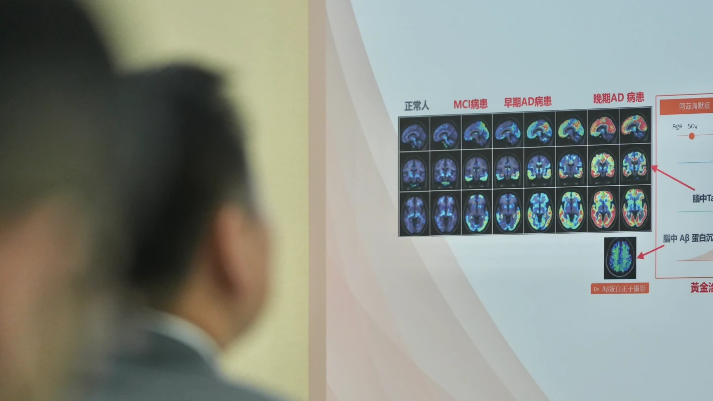 超高齡社會失智人口持續攀升　研究示警：Tau蛋白是惡化分水嶺