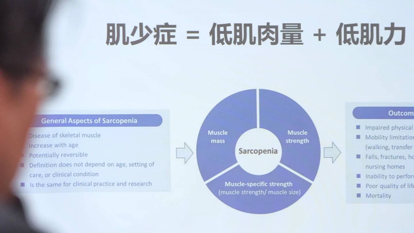 肌少症非老人專利！　亞洲最新共識：50歲就要開始篩檢2指標