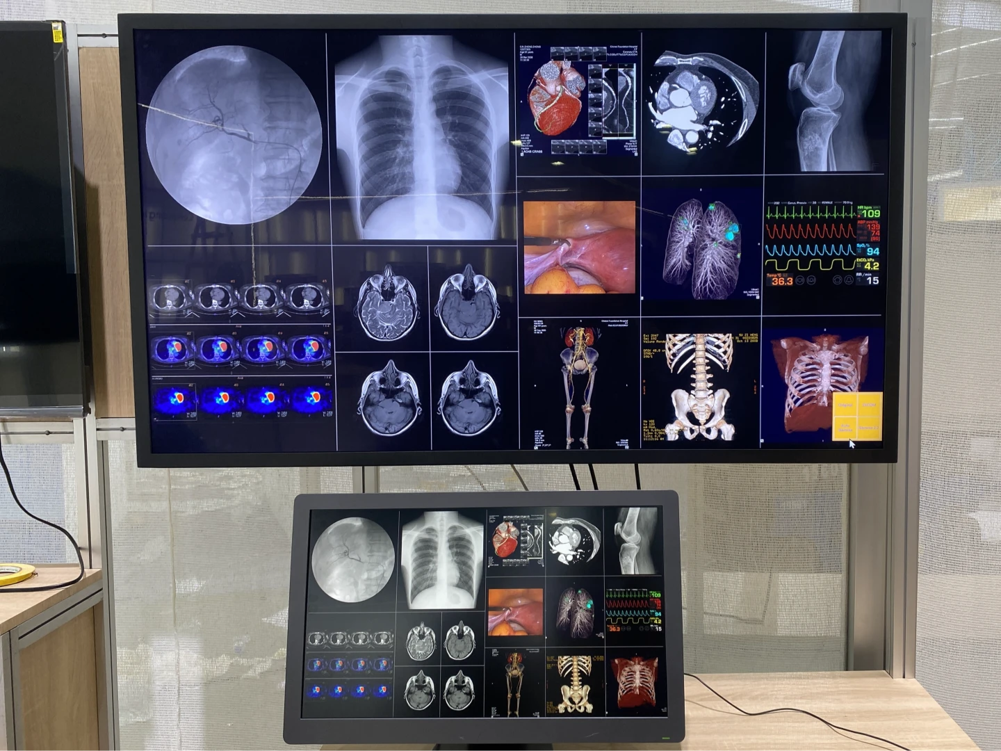 醫療科技展〡鈺緯首度亮相Mini LED醫療顯示器　服務國際第一階醫療客戶需求