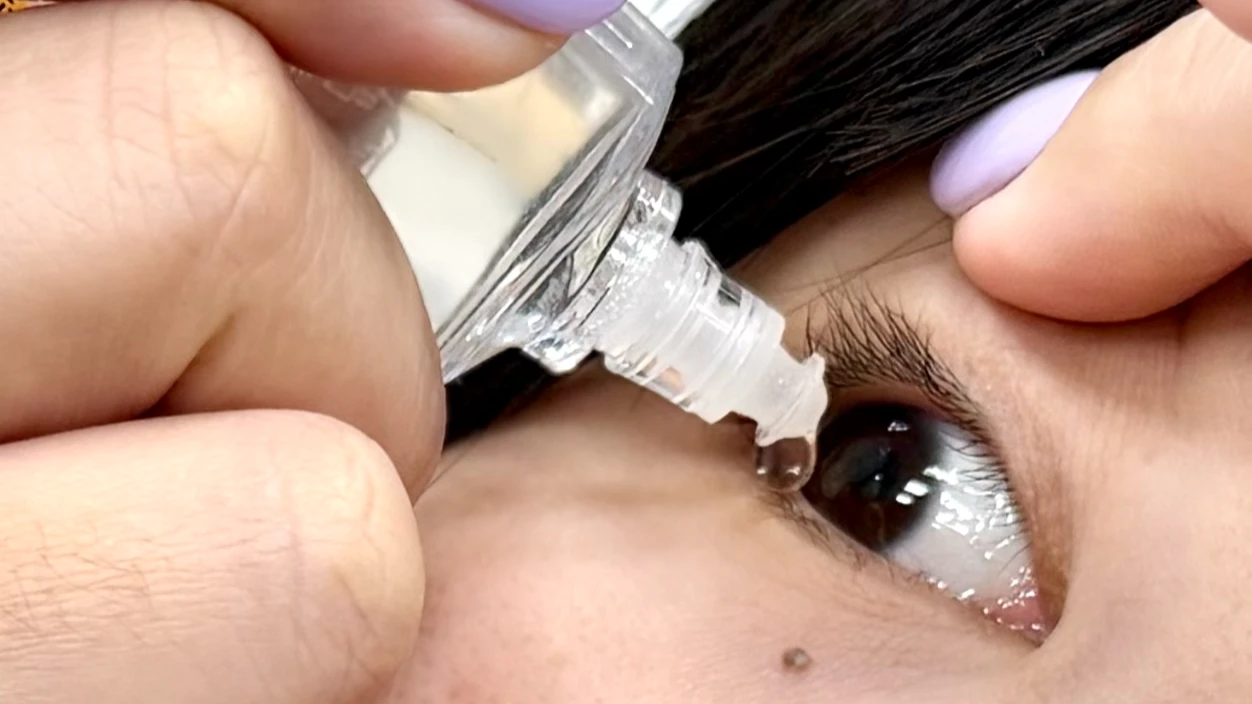 乾眼症患者逾300萬　醫：不只是缺水、關鍵在淚膜失衡