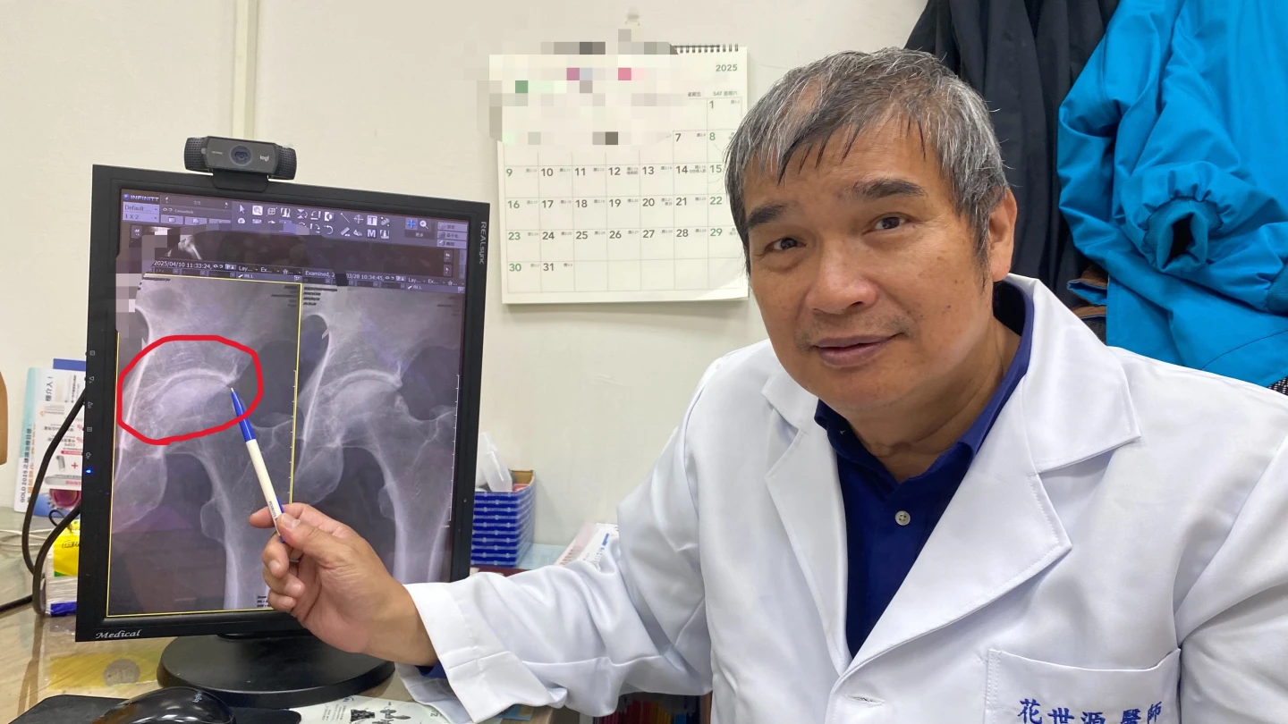 長時間深蹲注意！裝潢師傅一蹲卡住劇痛　髖關節夾擠症候群上身