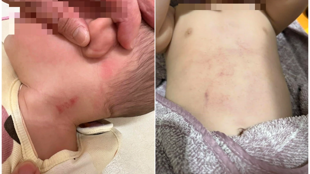 8月大嬰兒被打飛、重摔　台南保母虐童案擴大！6家長提告