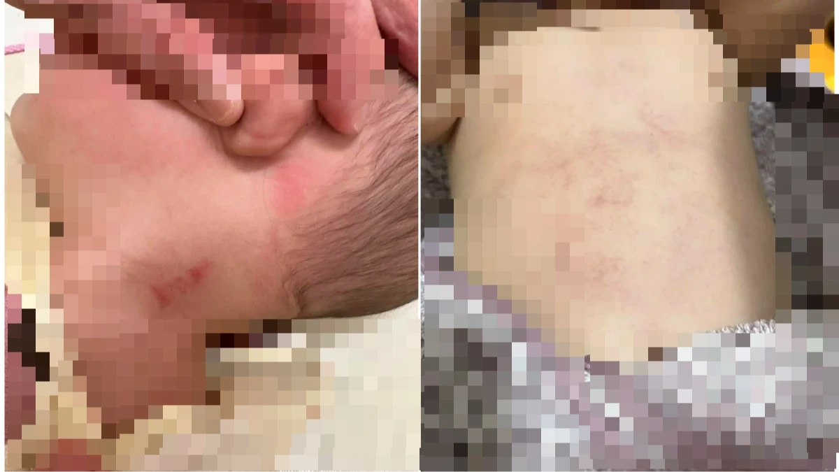 8月大嬰兒被打飛、重摔　台南保母虐童案擴大！6家長提告