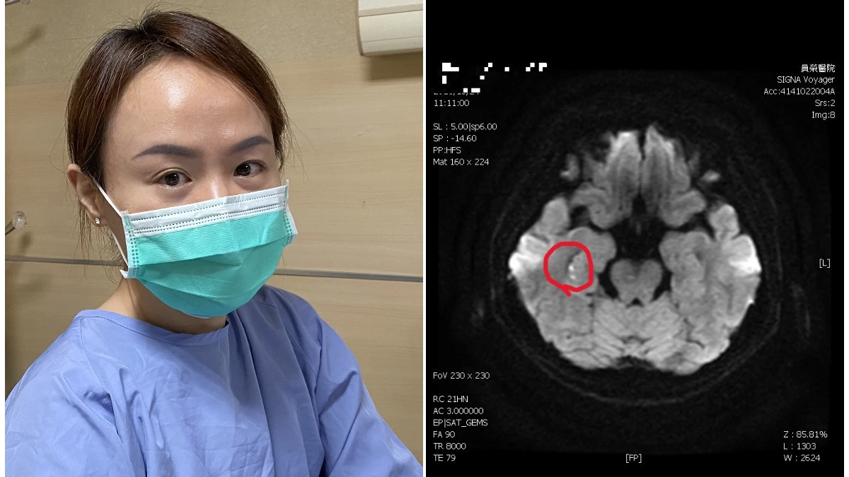 悲傷過度竟中風！婦人喪禮狂問同樣問題　失憶2小時