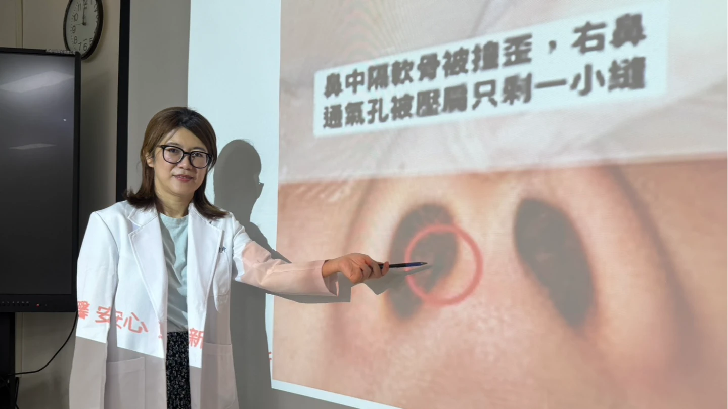 追撞意外毀容又鼻塞　「蘋果姐姐」自信盡失！3公分肋軟骨挽回挺鼻人生