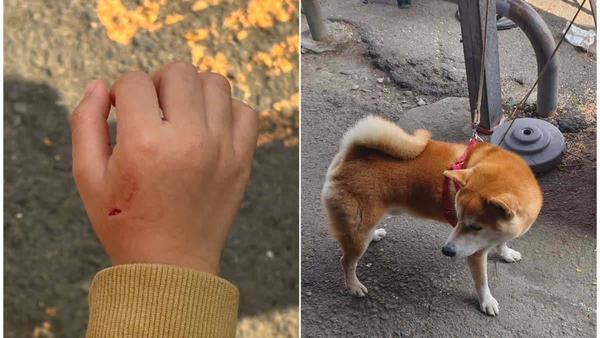 高雄4歲女童逛花市遭柴犬咬傷右手見血　一句道歉都沒有！家長怒告飼主