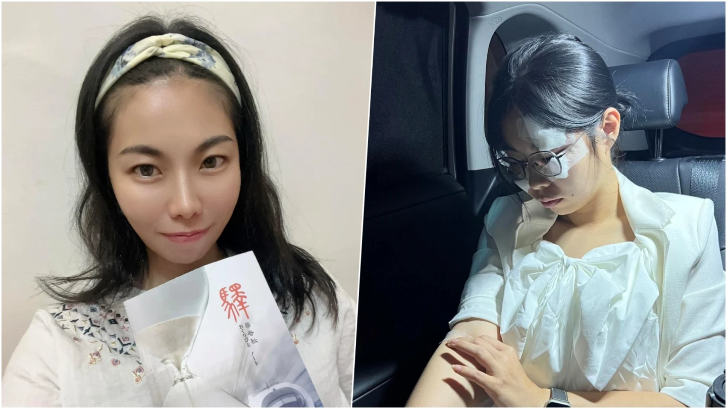 美女議員車禍！失去左眼視力　撞到人被罵「眼瞎了嗎？」難過做出1決定