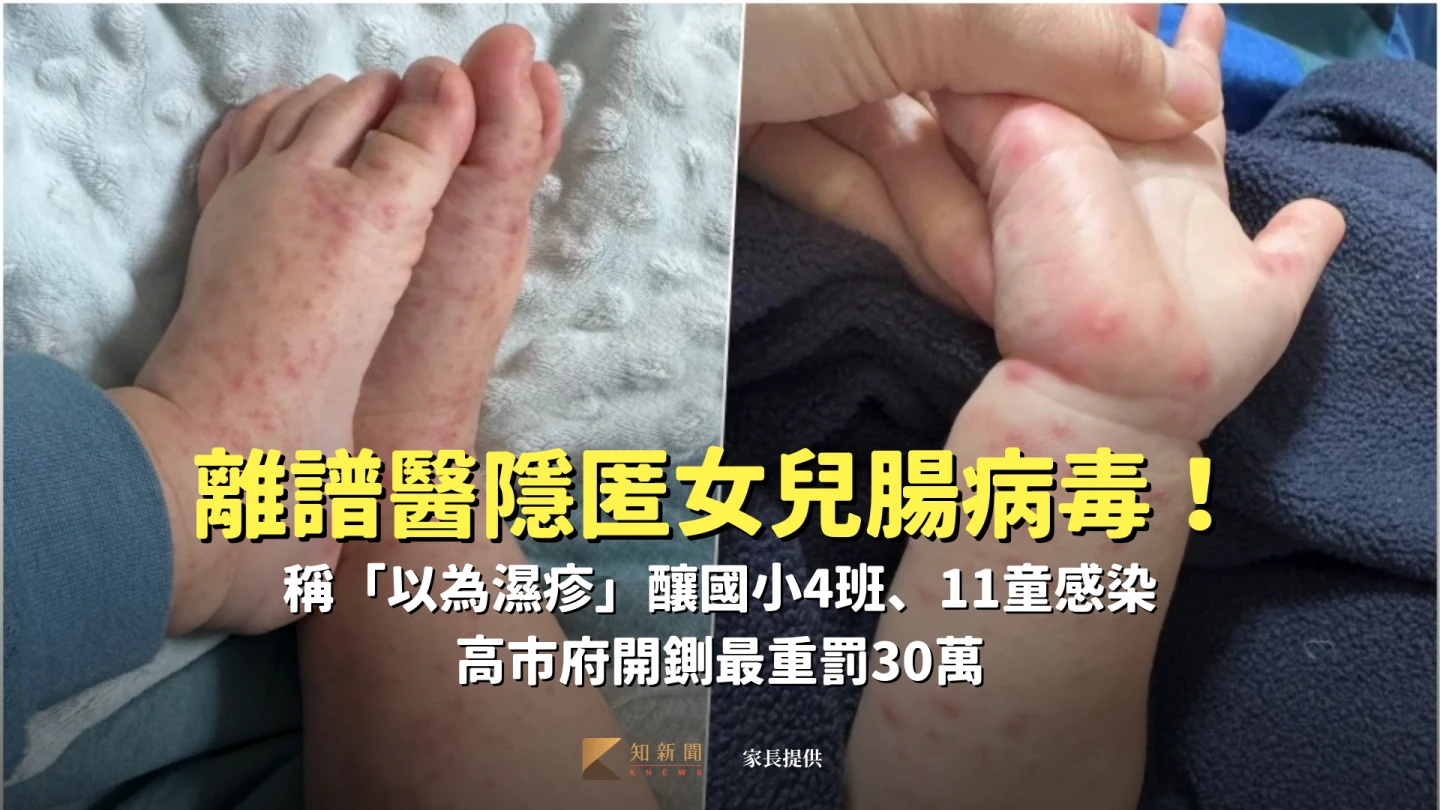 離譜醫隱匿女兒腸病毒！稱「以為濕疹」釀國小4班、11童感染　高市府開鍘最重罰30萬