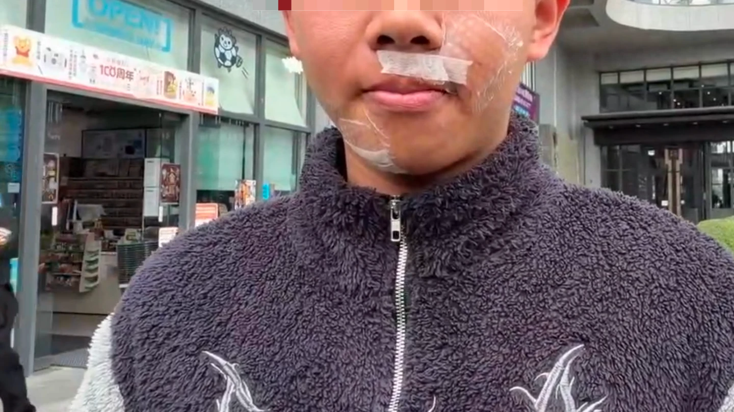 有片｜高雄清潔隊員當街爆打老夫婦！大學生見義勇為慘破相　「不幫忙對不起自己」