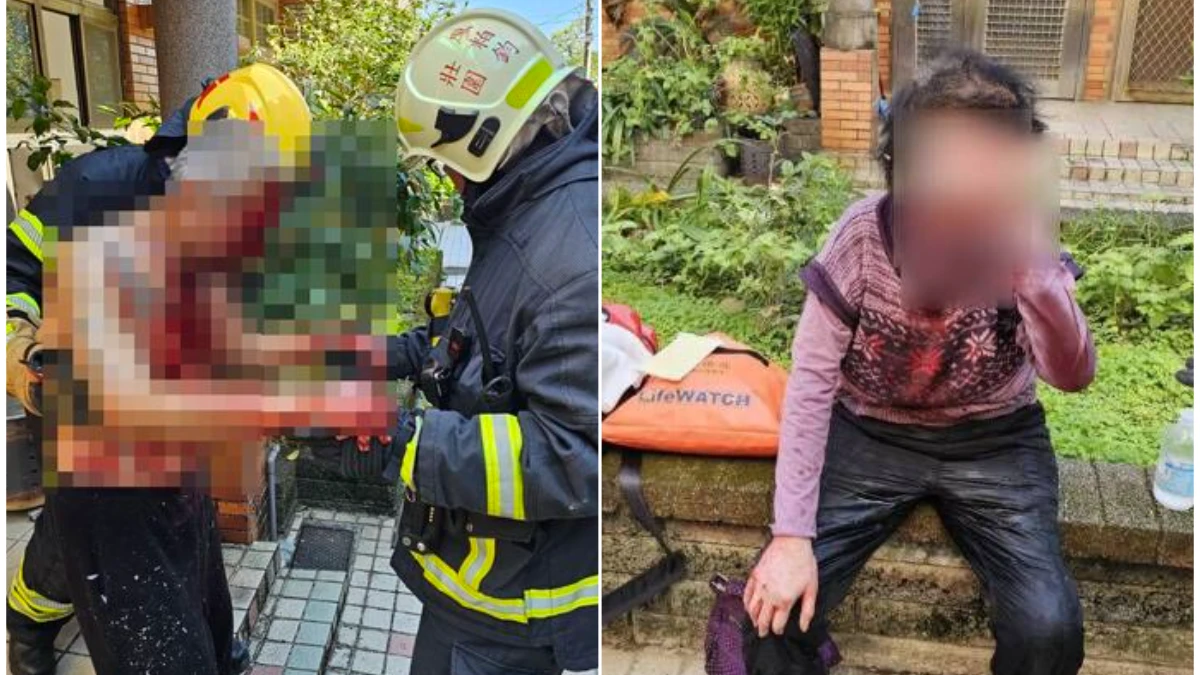 年前不平靜！宜蘭民宅氣爆疑「包裹爆炸」釀災　姐弟倆顏面肢體受傷送醫