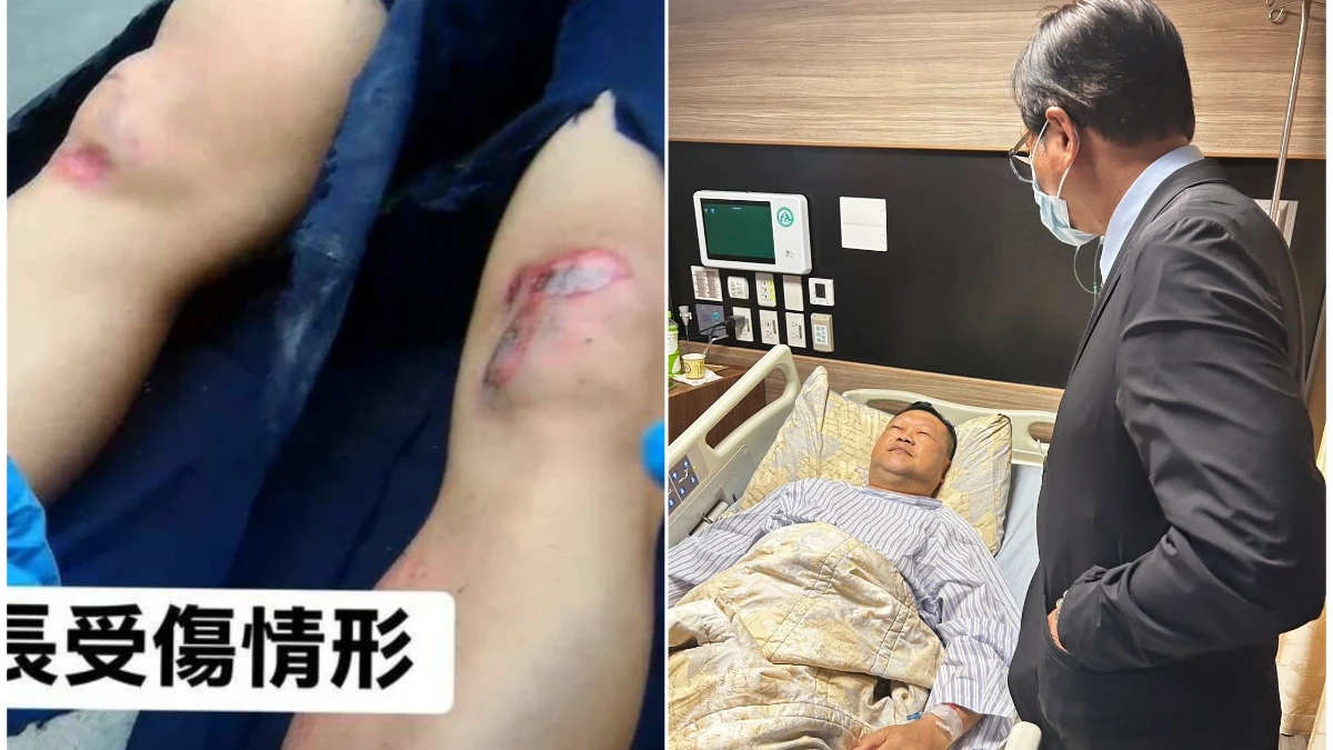 毒駕撞斷所長雙腿！毒蟲「無保請回」竟闖病房求和解　家屬嚇壞怒喊話法官