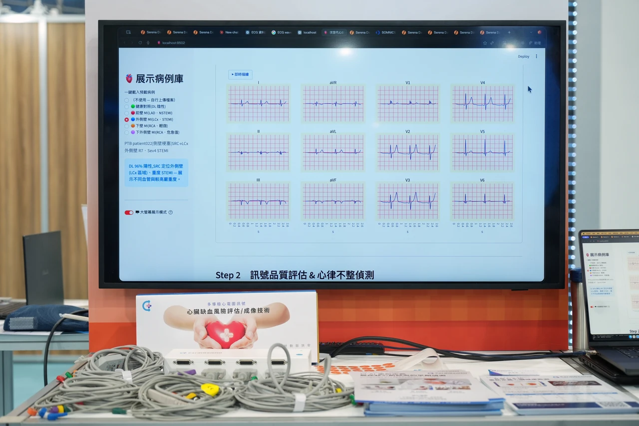 AI智慧健康展｜用心電圖檢測心肌缺血　無侵入性！準確度達85％