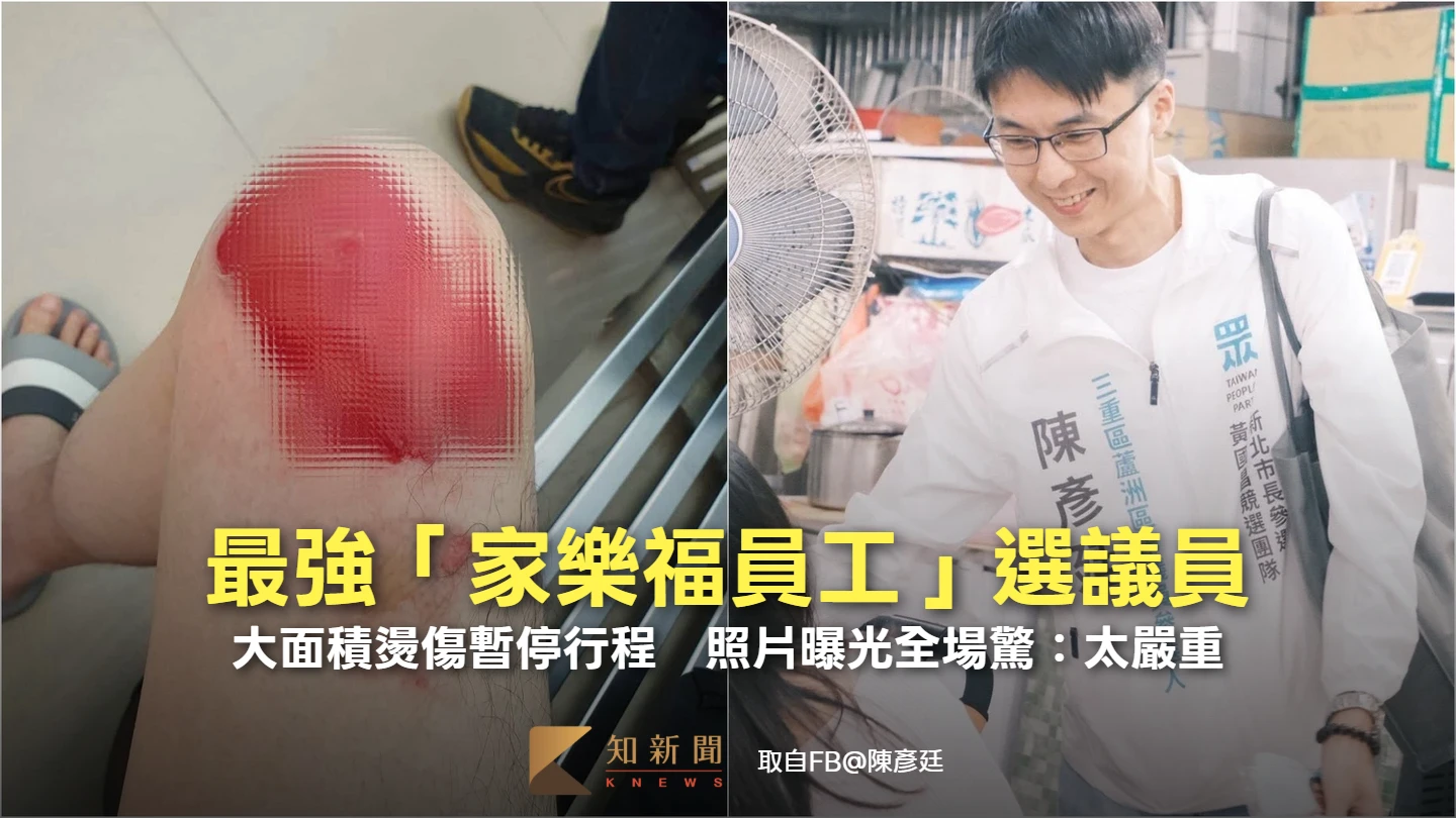 最強「家樂福員工」選議員！大面積燙傷暫停行程　照片曝光全場驚：太嚴重
