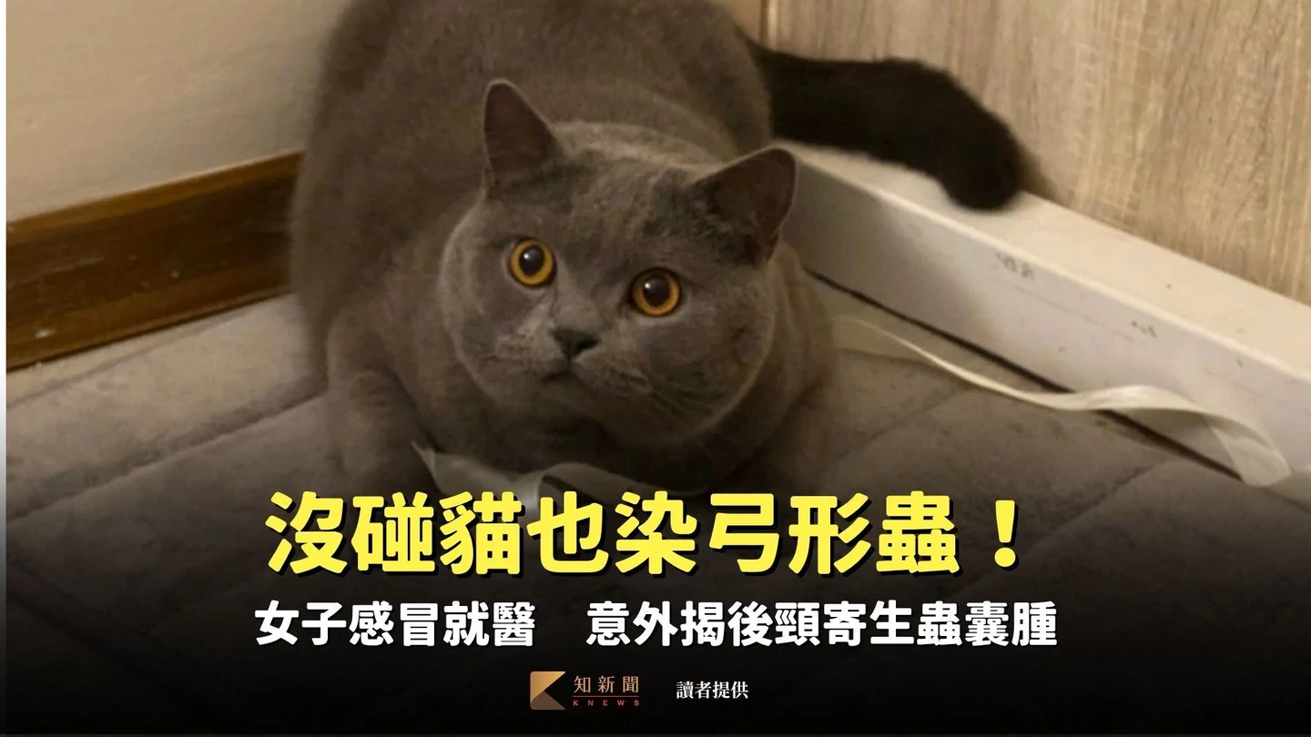 沒碰貓也染弓形蟲！女子感冒就醫　意外揭後頸寄生蟲囊腫