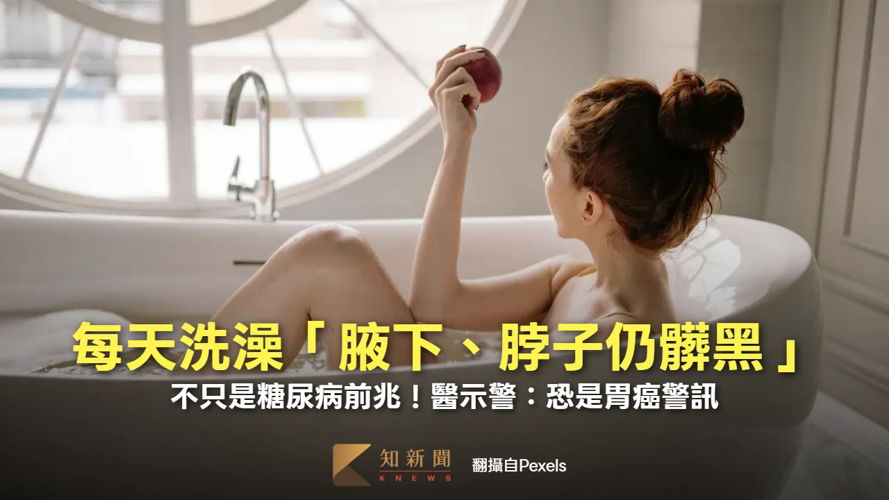 每天洗澡「腋下、脖子仍髒黑」　不只是糖尿病前兆！醫示警：恐是胃癌警訊