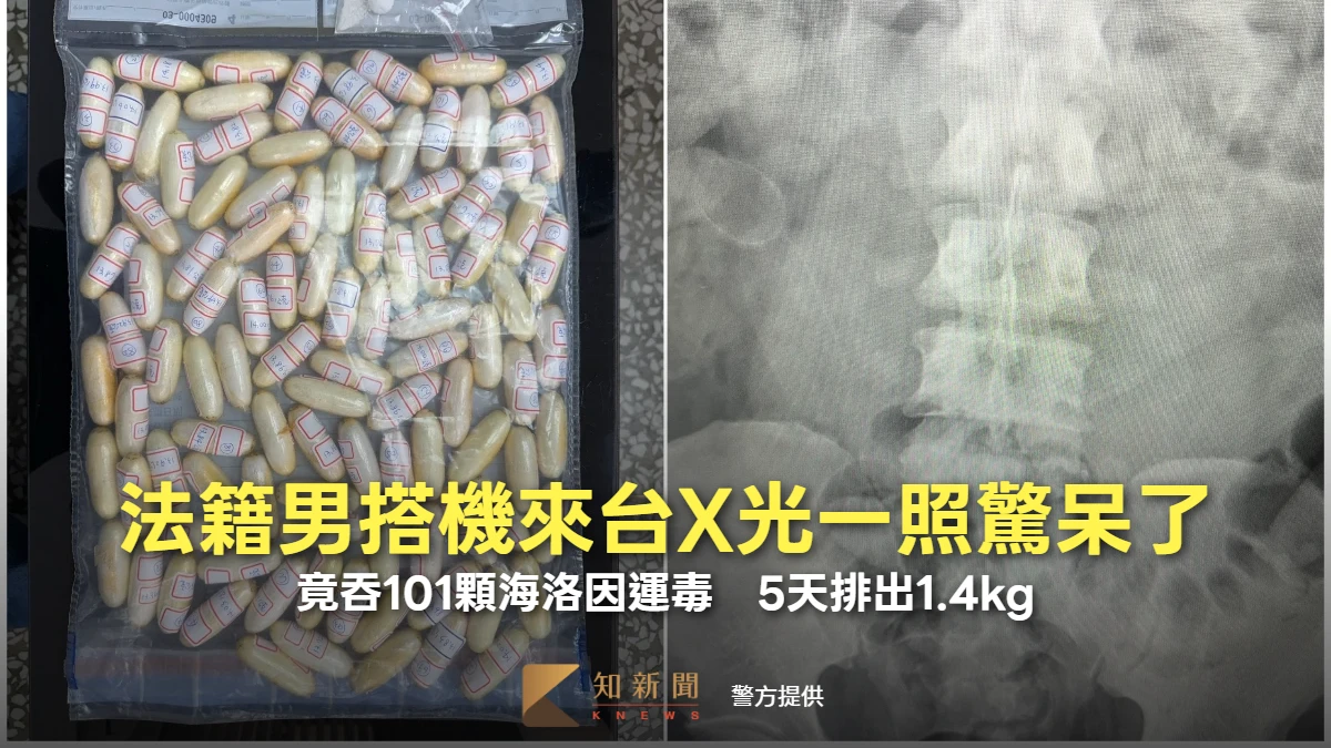 法籍男搭機來台X光一照驚呆了！竟吞101顆海洛因運毒　5天排出1.4kg