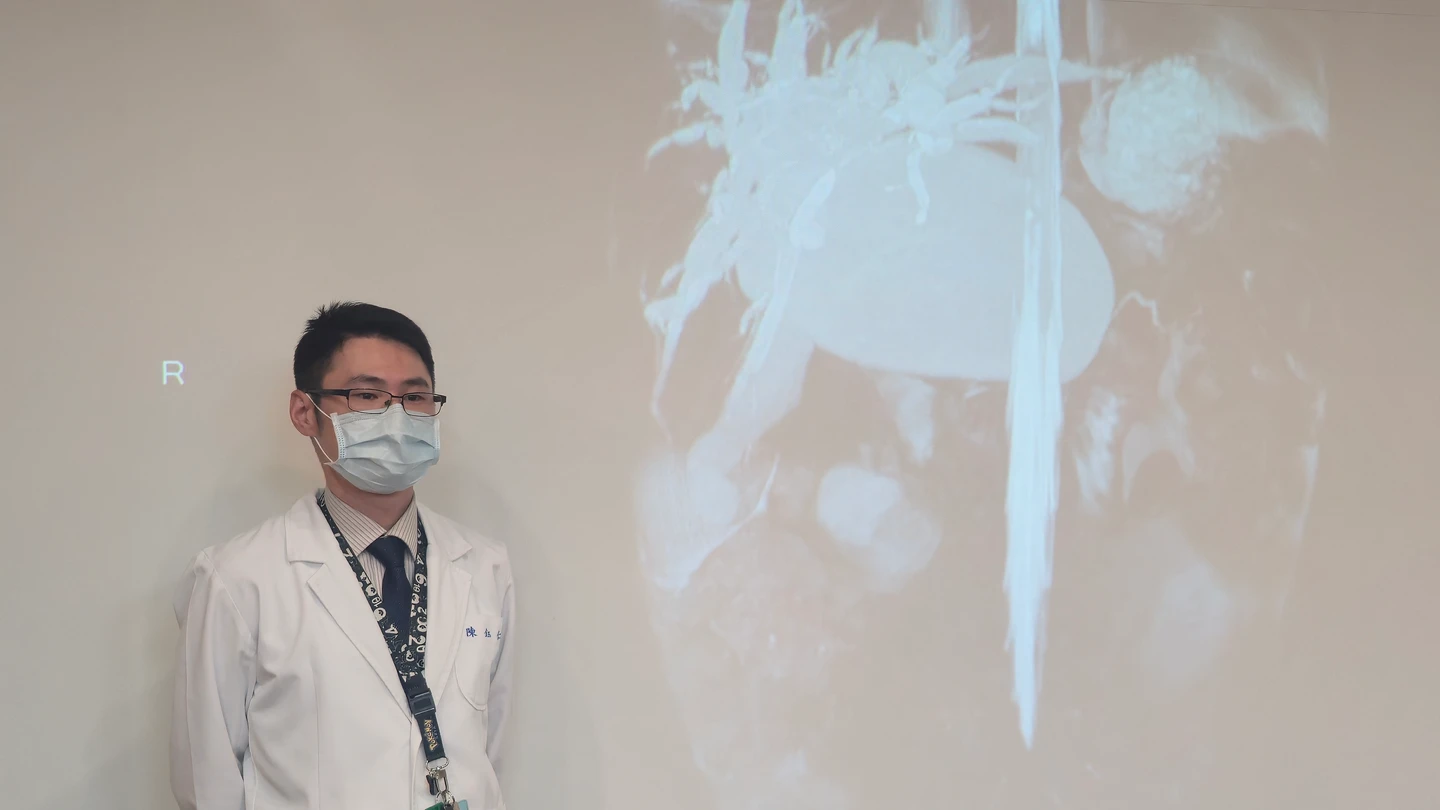 1歲女童腹脹黃疸確診罕病　醫：延誤治療恐增膽管癌風險
