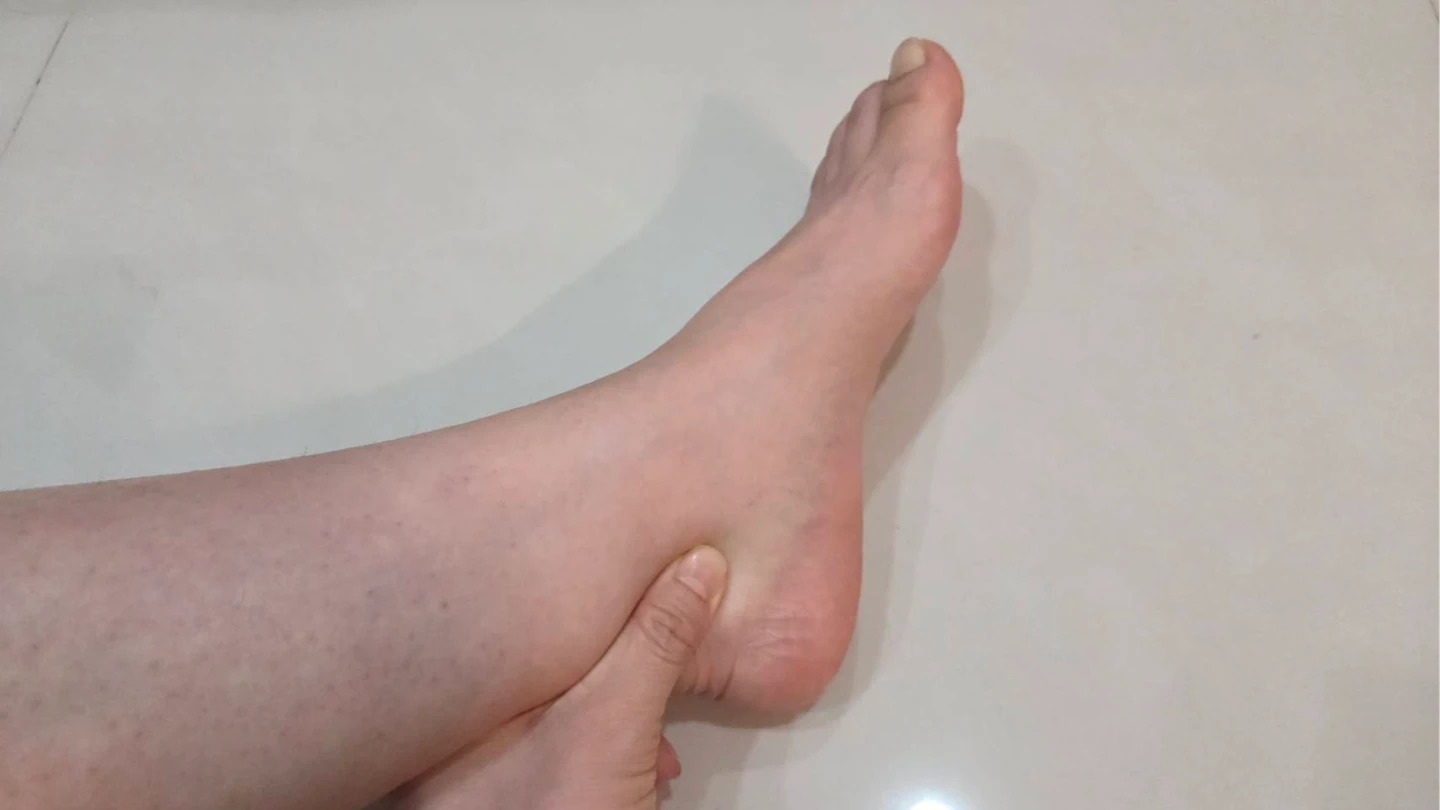 按3秒辨真胖或水腫！別急喝紅豆水　留意腎心肝求救訊號