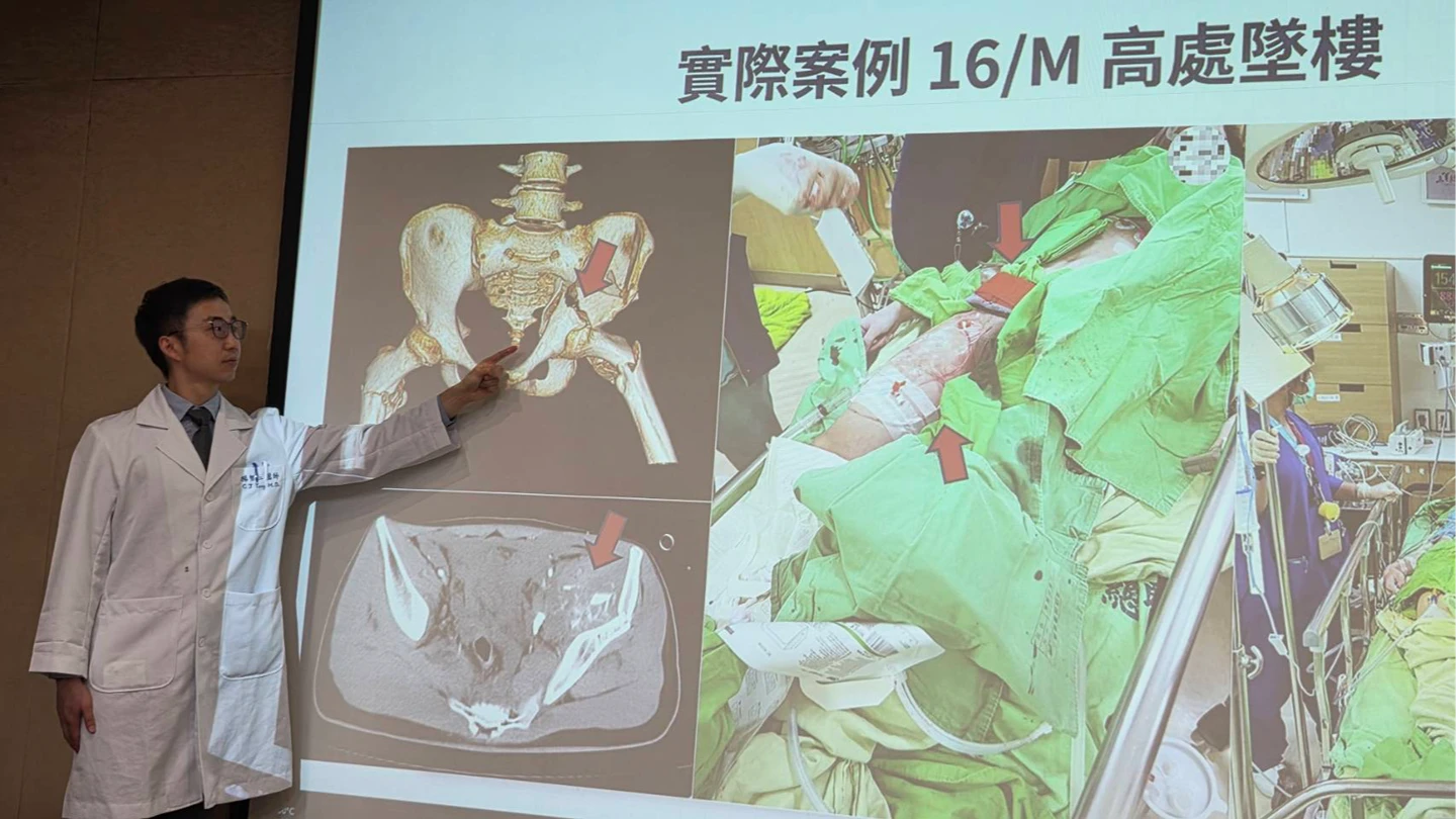 一分鐘輸血1公升、體內止血帶雙管齊下　三總救回墜樓少年