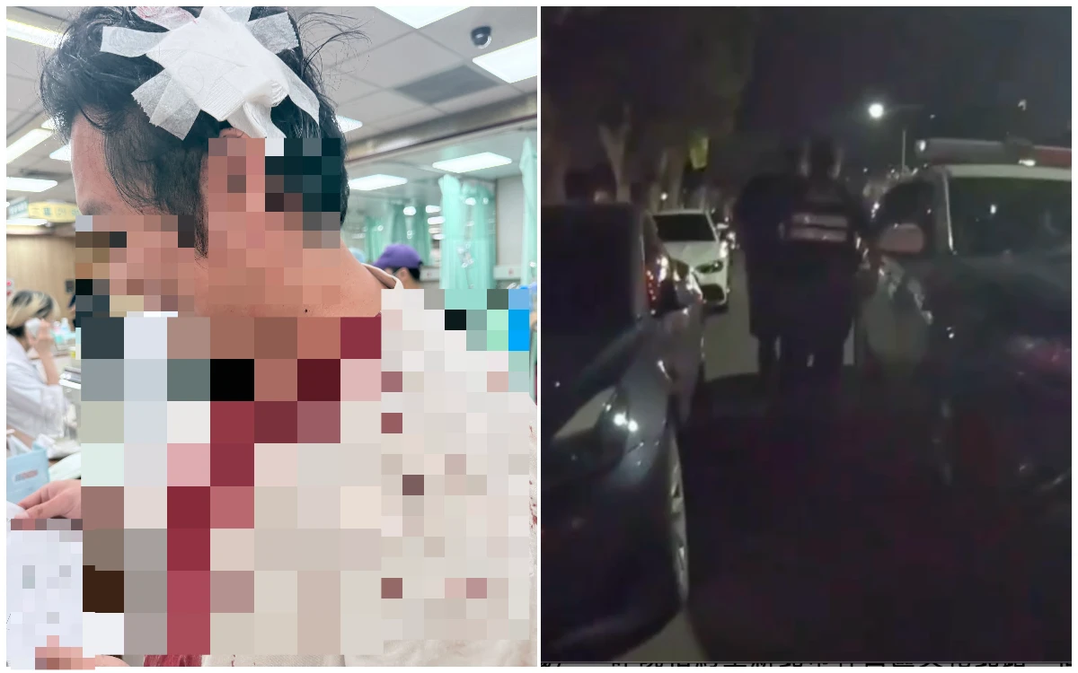 釣蝦場成格鬥場！3男室內抽菸遭檢舉　竟拿酒瓶砸傷顧客頭
